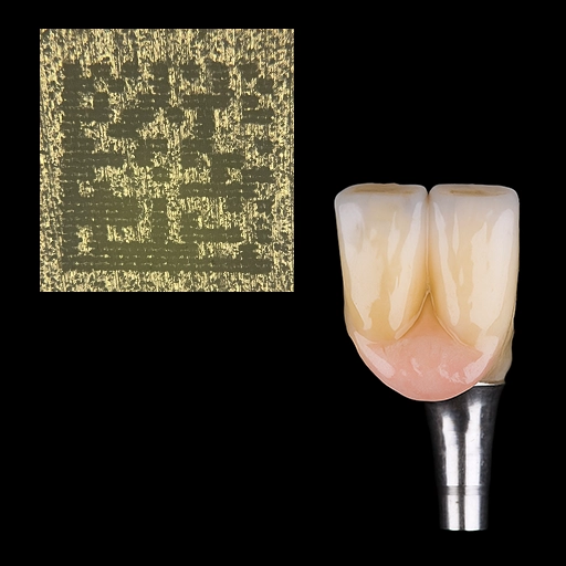 Direct marking on dental ceramics
